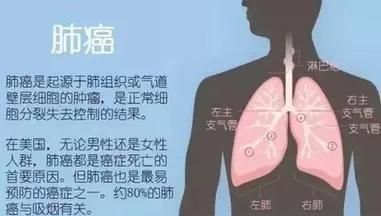 每天抽烟喝酒的人身体怎么样图3